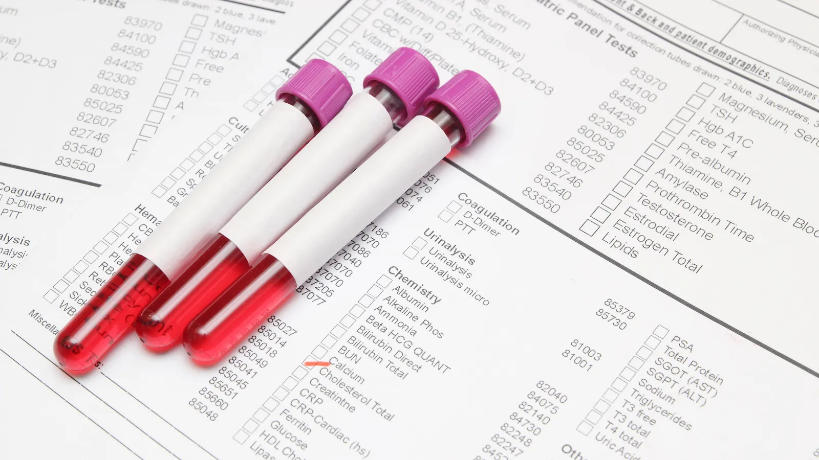 Blood sample tubes with purple caps resting on a laboratory test request form